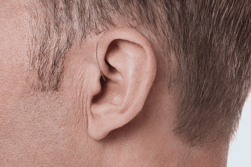 Appareil auditif Oticon More, modèle miniRITE R, couleur Gris clair, photo prise sous un angle de 90°, Gros plan sur l'oreille, Homme Appareils auditifs avec service illimité Auzen